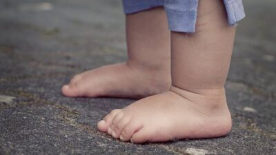 Kenapa Kaki Gatal Pas Berdiri